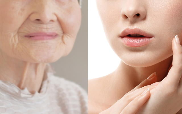 Mechanisms of Skin Aging